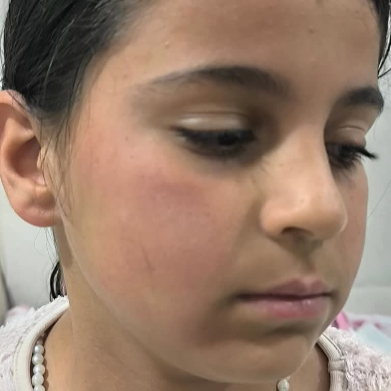 Duş Jeli Yüzde Kullanılır mı? Uzman Uyarıları ve Doğru Seçim - Kapak Görseli